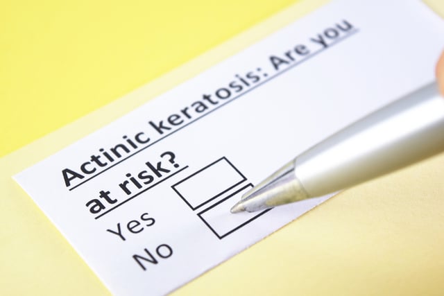 Actinic keratosis are you at risk yes or no