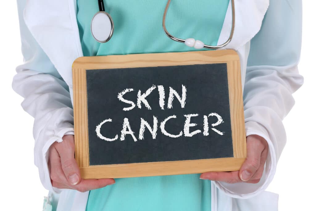 A cropped shot of a doctor holding a chalkboard with “Skin Cancer” written on it