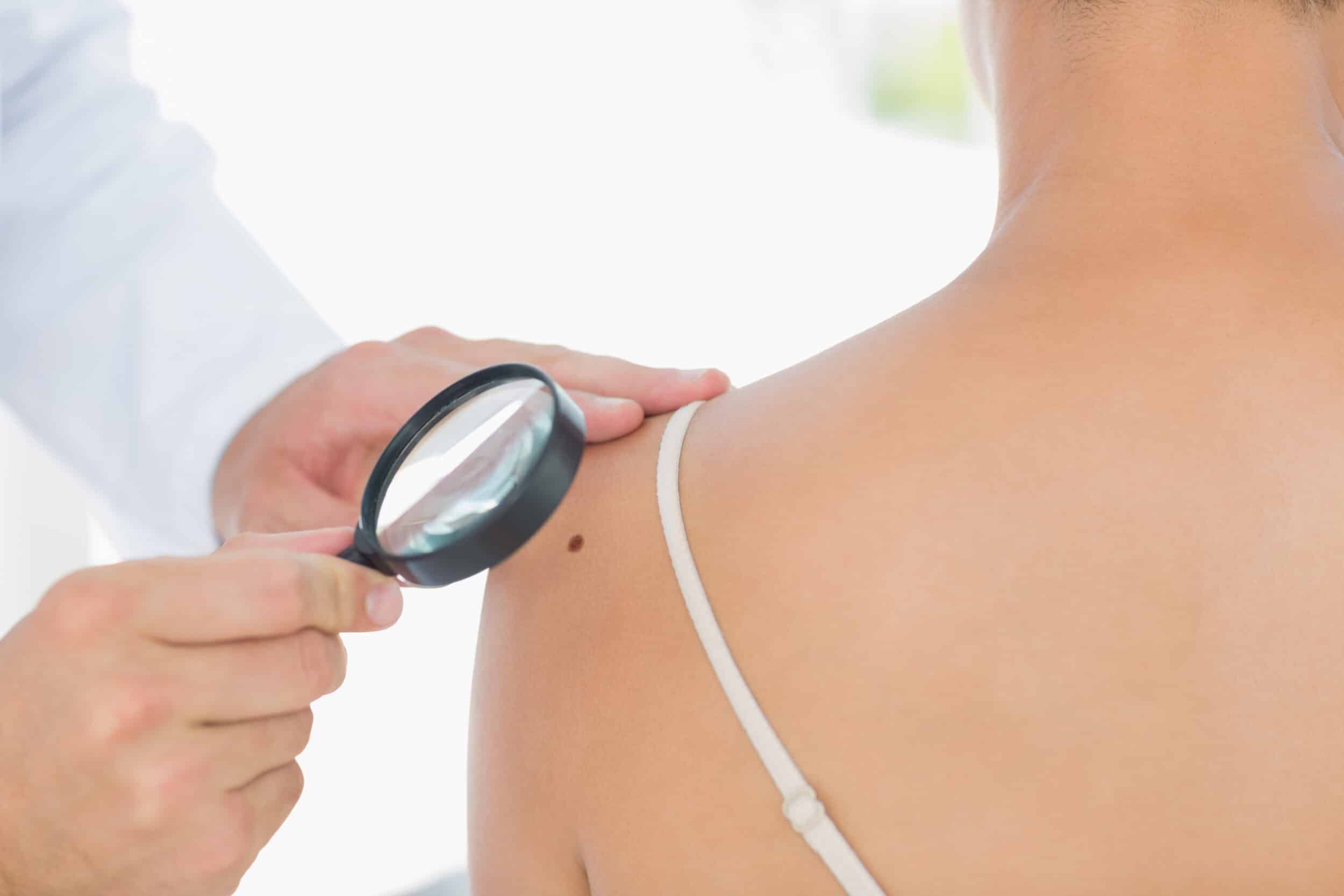 Doctor examining skin of a patient