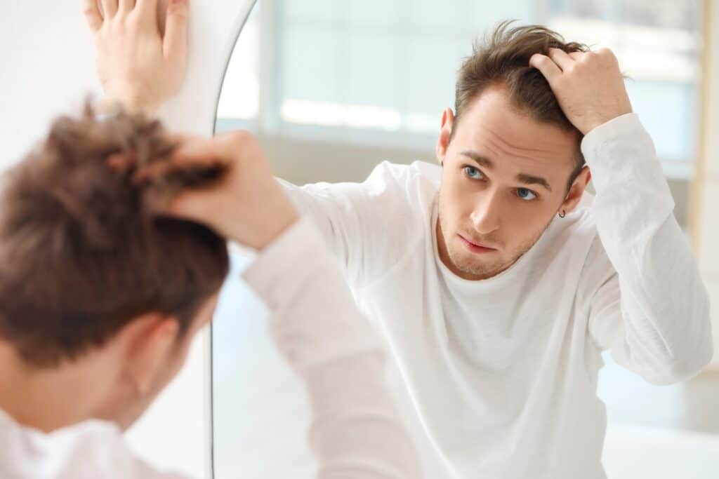 A young man looks in the mirror at home, concerned about thinning hair and bald spots that may be early signs of alopecia